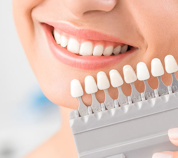 Agoura Hills Dental Veneers and Dental Laminates