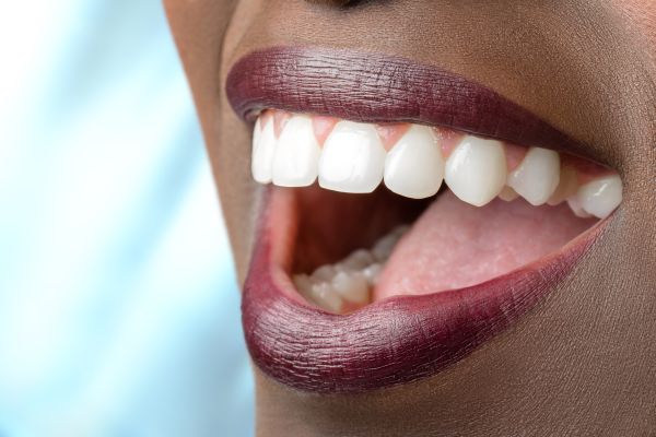 How Long Does Full Mouth Reconstruction Take?