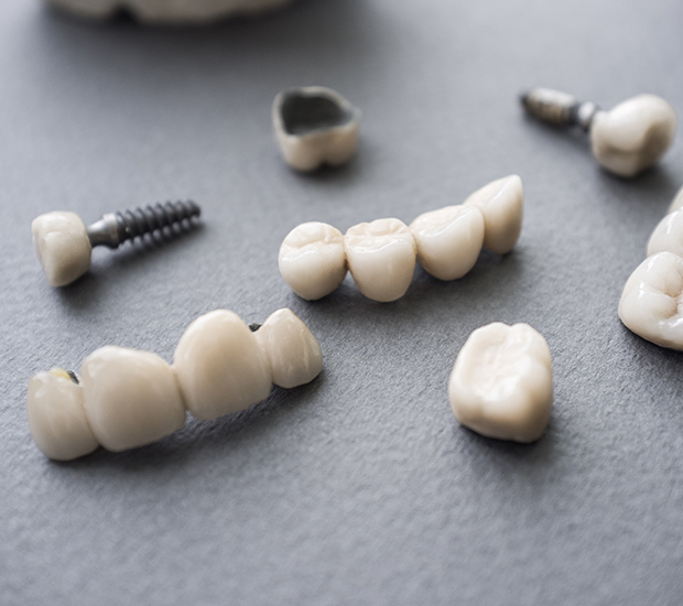 Agoura Hills The Difference Between Dental Implants and Mini Dental Implants