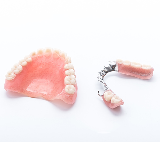 Agoura Hills Partial Dentures for Back Teeth