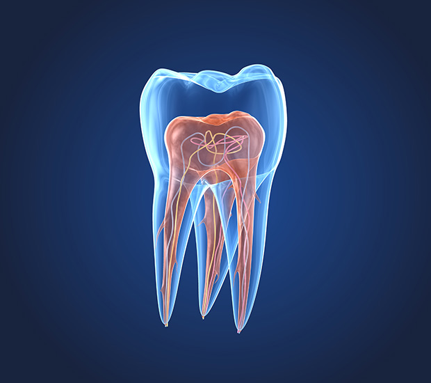 Agoura Hills What is an Endodontist